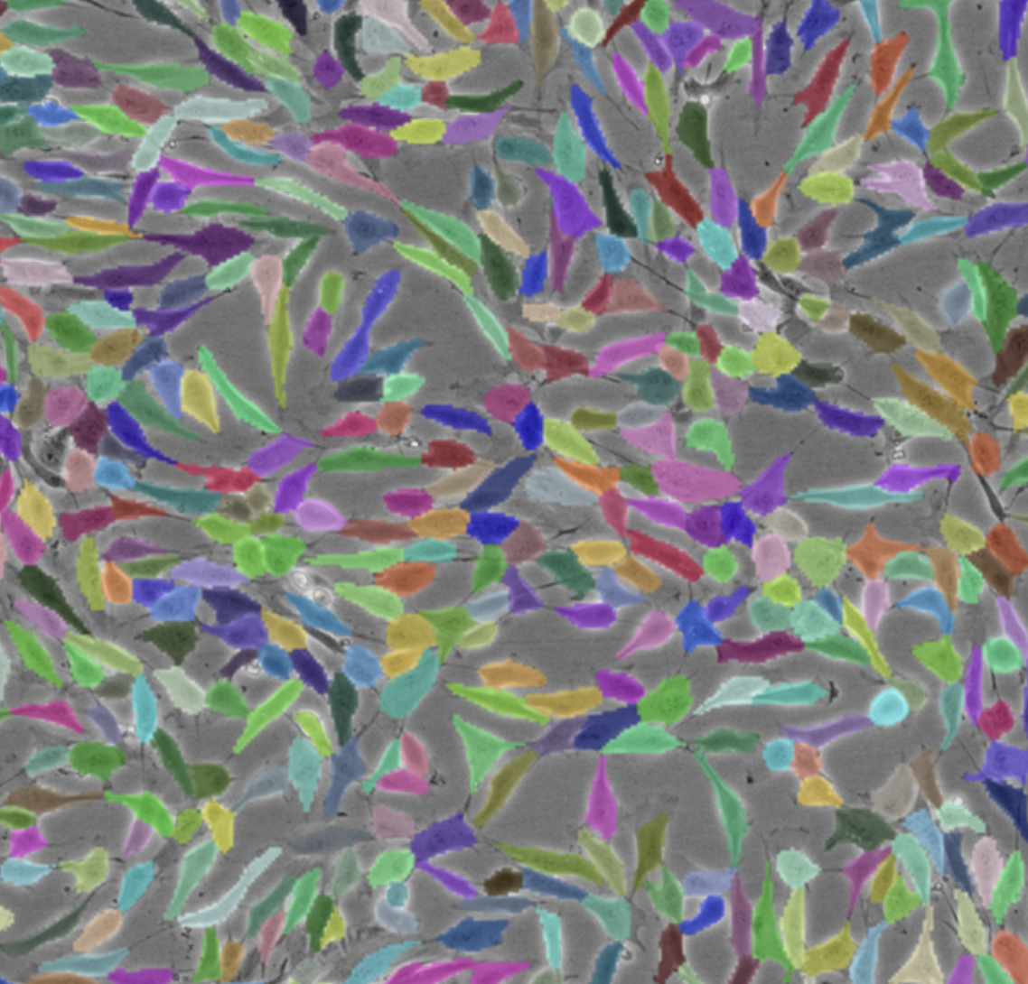 Deep learning cell segmentation count